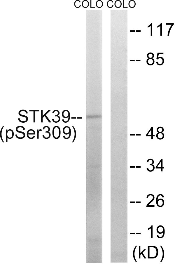 Rabbit Polyclonal Antibody to STK39 (Phospho-Ser309)