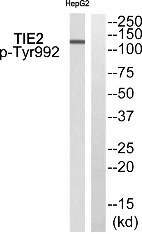 Rabbit Polyclonal Antibody to TIE2 (Phospho-Tyr992)