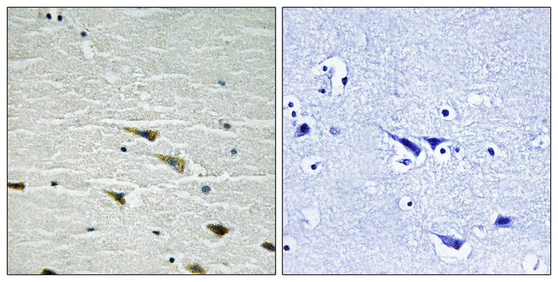 Rabbit Polyclonal Antibody to Trk A (Phospho-Tyr757)