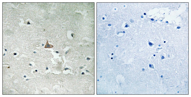 Rabbit Polyclonal Antibody to Trk B (Phospho-Tyr706/Tyr707)
