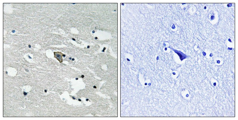 Rabbit Polyclonal Antibody to VEGFR1 (Phospho-Tyr1048)