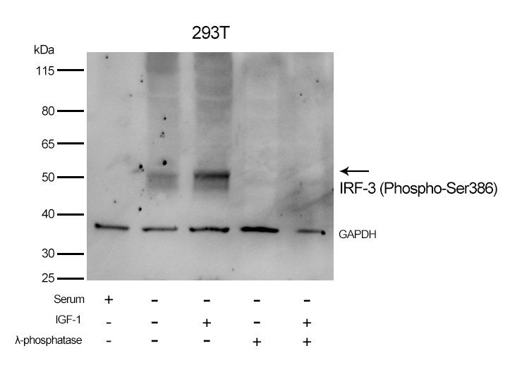 Rabbit Polyclonal Antibody to IRF-3 (Phospho-Ser386)