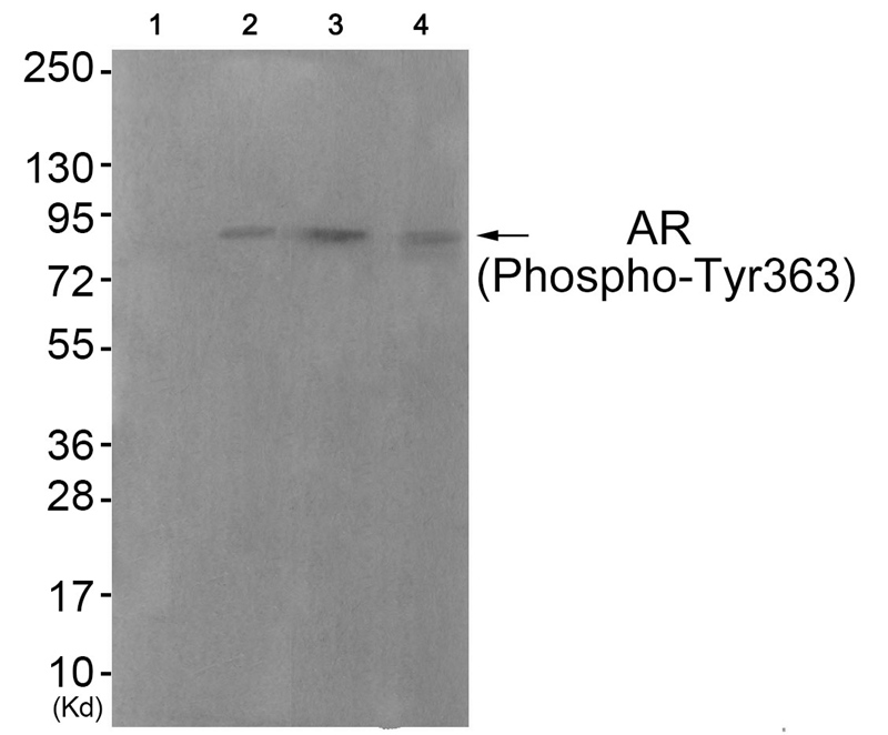 Rabbit Polyclonal Antibody to Androgen Receptor (Phospho-Tyr363)