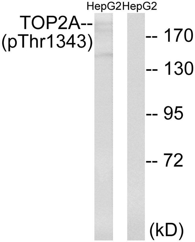 Rabbit Polyclonal Antibody to TOP2A (Phospho-Thr1343)
