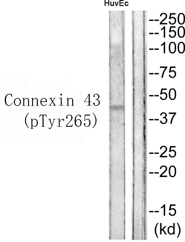Rabbit Polyclonal Antibody to Connexin 43 (Phospho-Tyr265)