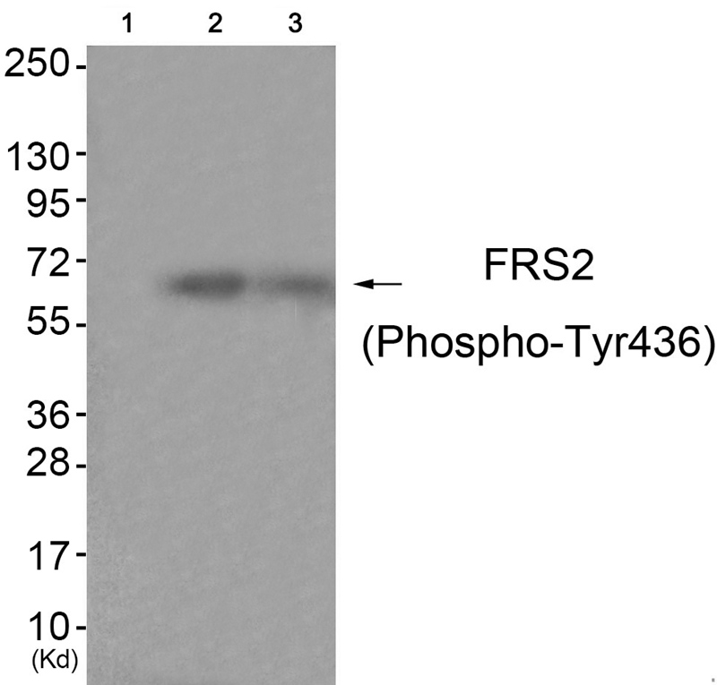Rabbit Polyclonal Antibody to FRS2 (Phospho-Tyr436)