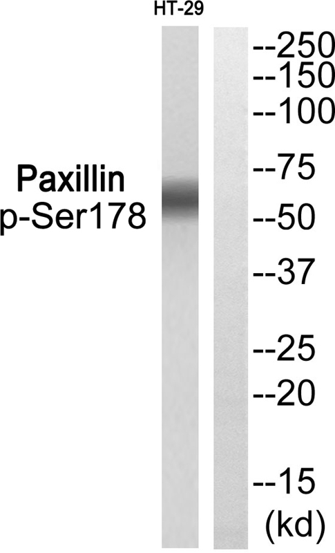 Rabbit Polyclonal Antibody to Paxillin (Phospho-Ser178)