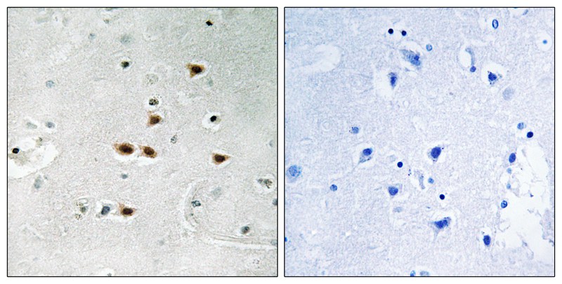 Rabbit Polyclonal Antibody to ITCH (Phospho-Tyr420)