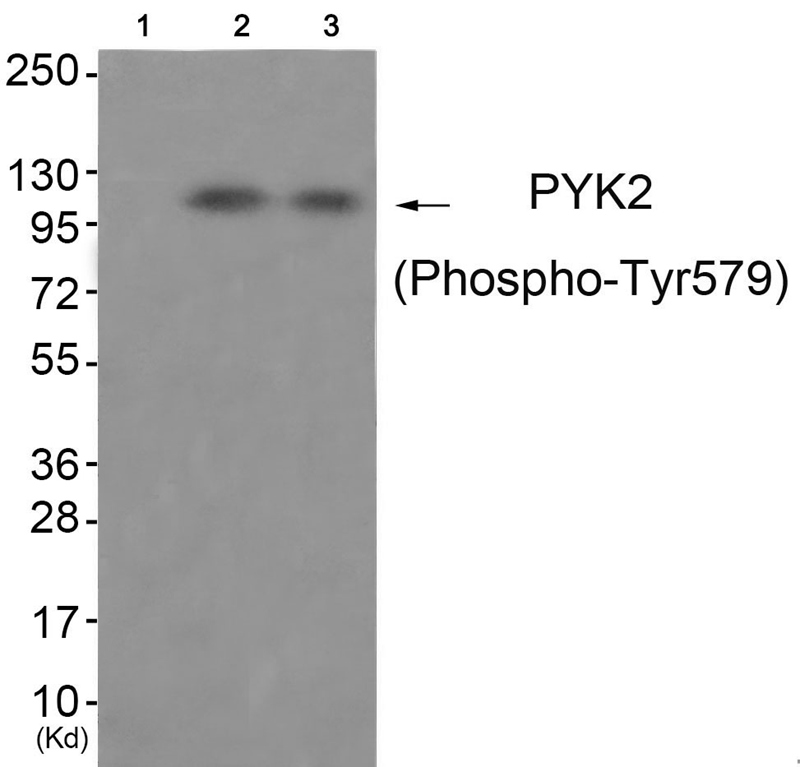 Rabbit Polyclonal Antibody to PYK2 (Phospho-Tyr579)