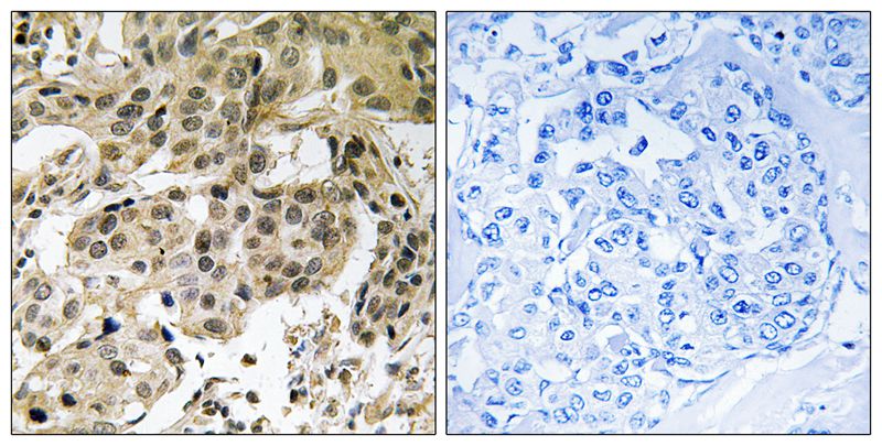 Rabbit Polyclonal Antibody to HP1α (Phospho-Ser92)