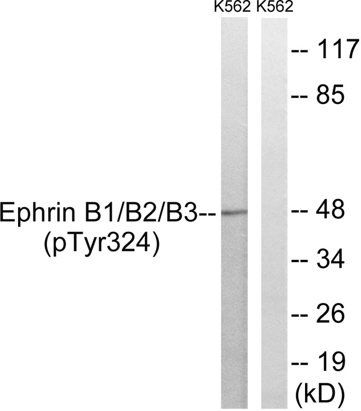 Rabbit Polyclonal Antibody to Ephrin B1/B2/B3 (phospho Y324/Y311/Y318)