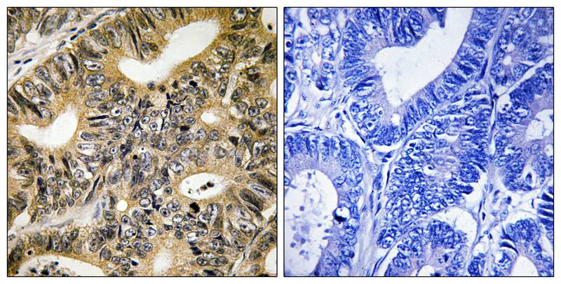 Rabbit Polyclonal Antibody to 4E-BP1 (Phospho-Thr70)