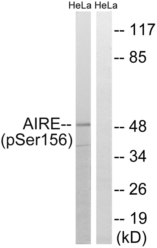 Rabbit Polyclonal Antibody to AIRE (Phospho-Ser156)