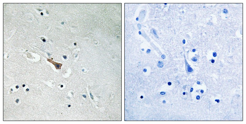 Rabbit Polyclonal Antibody to APLP2 (Phospho-Tyr755)