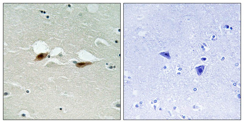 Rabbit Polyclonal Antibody to ATF-2 (Phospho-Ser472)