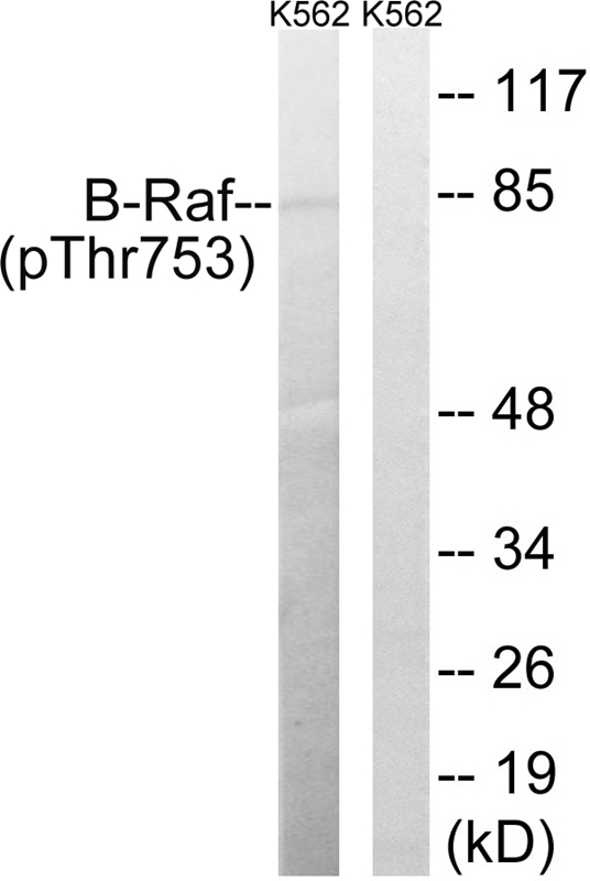 Rabbit Polyclonal Antibody to B-Raf (Phospho-Thr753)