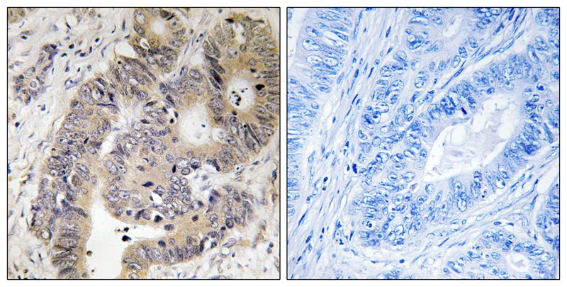 Rabbit Polyclonal Antibody to CAD (Phospho-Thr456)