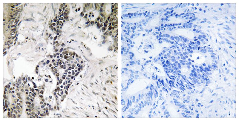Rabbit Polyclonal Antibody to CDC25C (Phospho-Ser198)