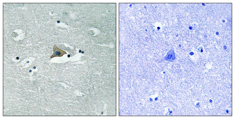 Rabbit Polyclonal Antibody to Claudin 5 (Phospho-Tyr217)