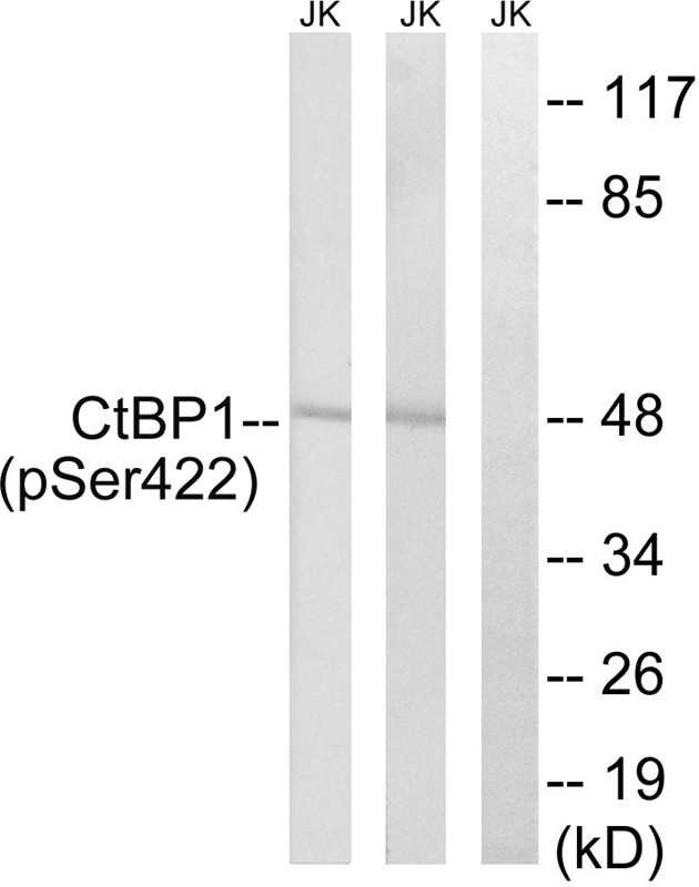 Rabbit Polyclonal Antibody to CtBP1 (Phospho-Ser422)