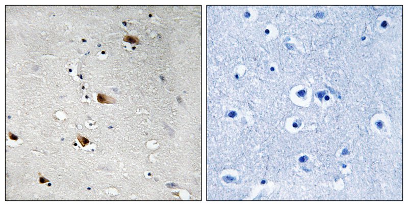 Rabbit Polyclonal Antibody to E2A (Phospho-Thr355)
