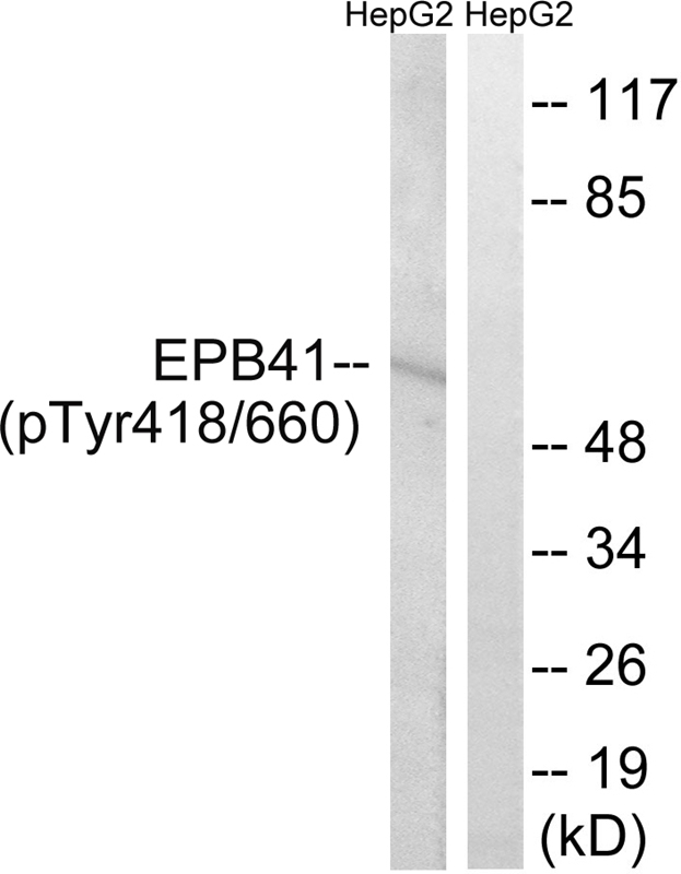 Rabbit Polyclonal Antibody to EPB41 (Phospho-Tyr660/418)