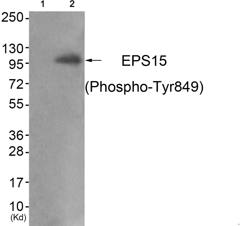 Rabbit Polyclonal Antibody to EPS15 (Phospho-Tyr849)