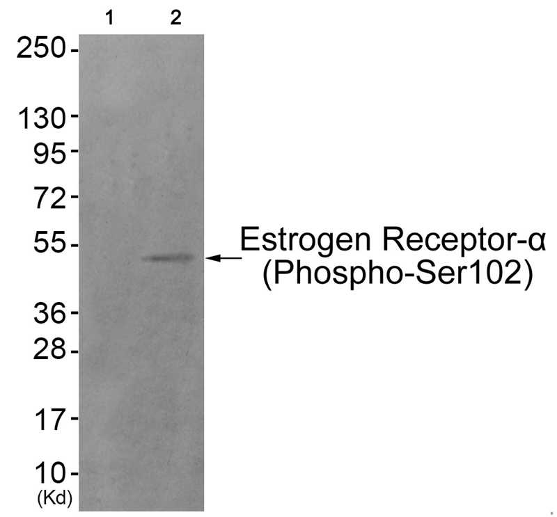 Rabbit Polyclonal Antibody to Estrogen Receptor-α (Phospho-Ser102)