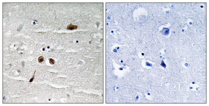 Rabbit Polyclonal Antibody to MDC1 (Phospho-Ser513)