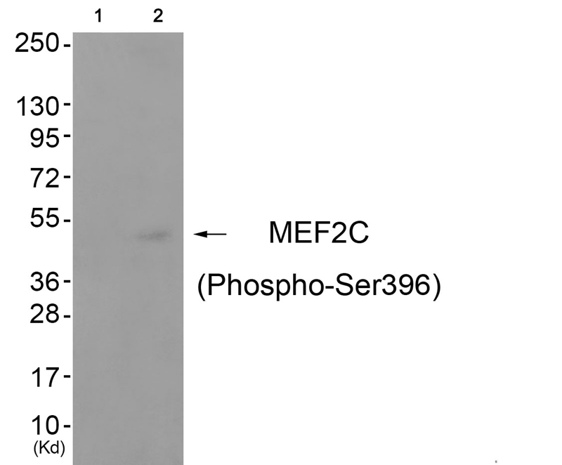 Rabbit Polyclonal Antibody to MEF2C (Phospho-Ser396)