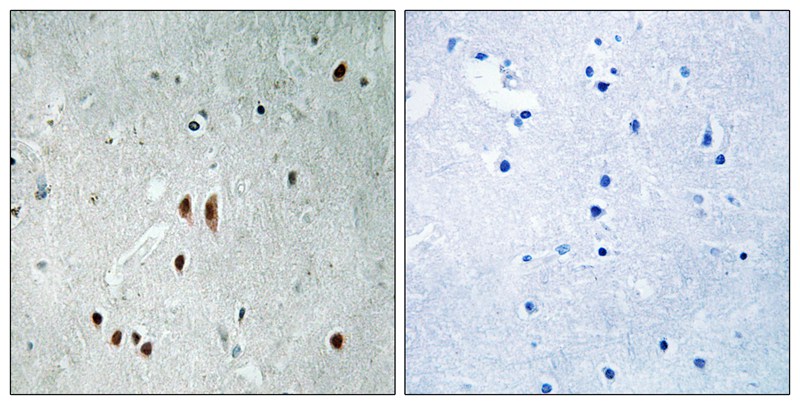 Rabbit Polyclonal Antibody to CNOT2 (Phospho-Ser101)