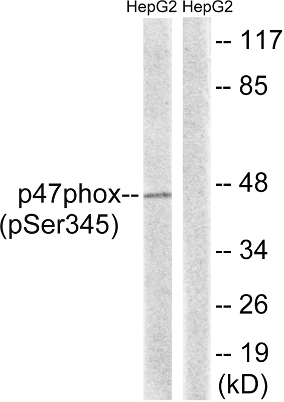 Rabbit Polyclonal Antibody to p47 phox (Phospho-Ser345)