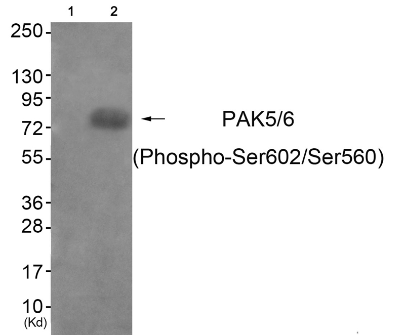 Rabbit Polyclonal Antibody to PAK5/6 (Phospho-Ser602/Ser560)
