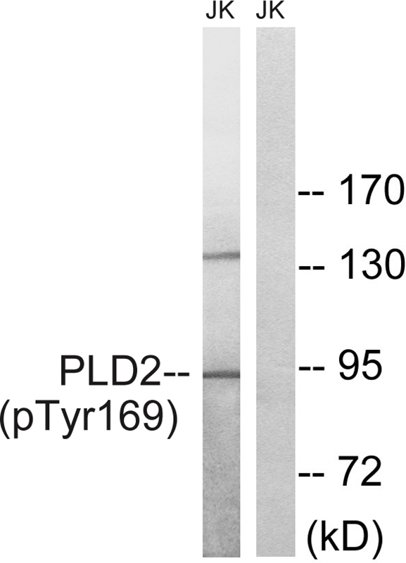 Rabbit Polyclonal Antibody to PLD2 (Phospho-Tyr169)