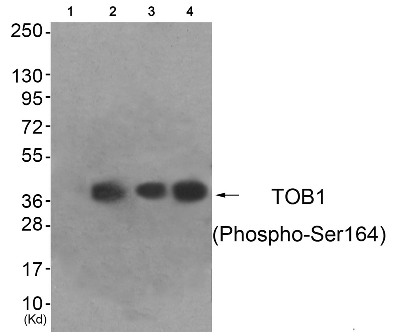 Rabbit Polyclonal Antibody to TOB1 (Phospho-Ser164)
