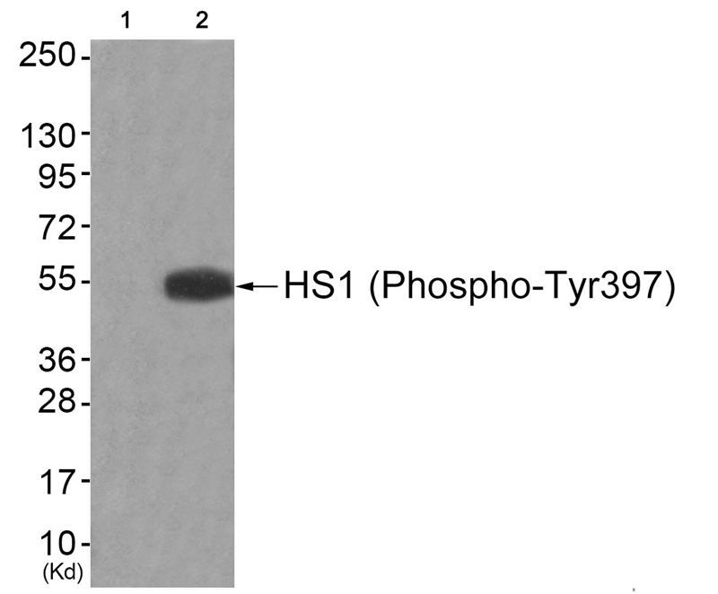 Rabbit Polyclonal Antibody to HS1 (Phospho-Tyr397)