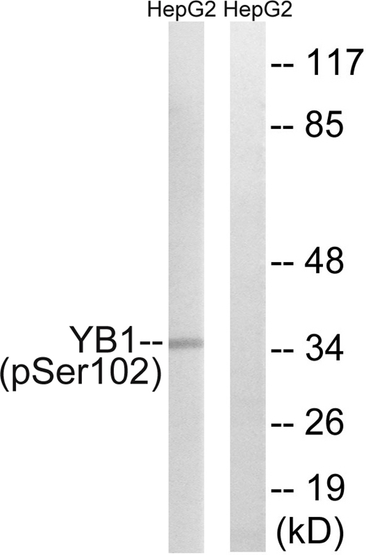 Rabbit Polyclonal Antibody to YB1 (Phospho-Ser102)