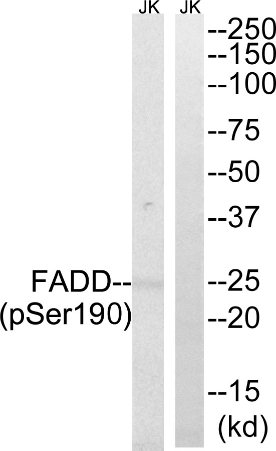 Rabbit Polyclonal Antibody to FADD (Phospho-Ser191)