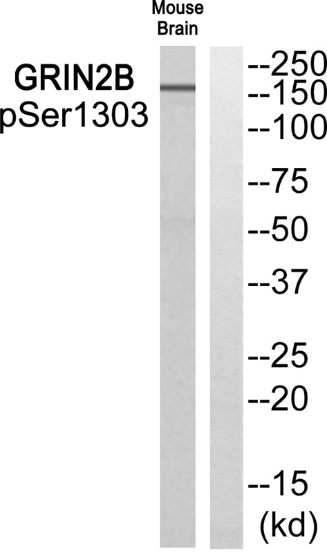 Rabbit Polyclonal Antibody to GRIN2B (Phospho-Ser1303)