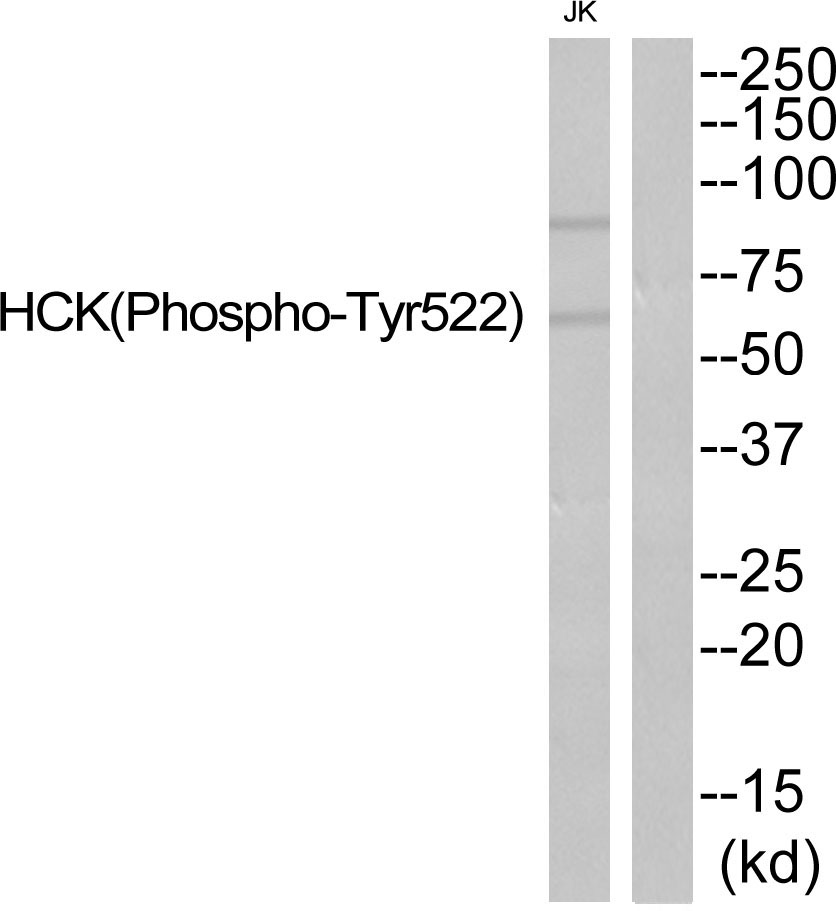 Rabbit Polyclonal Antibody to HCK (Phospho-Tyr522)