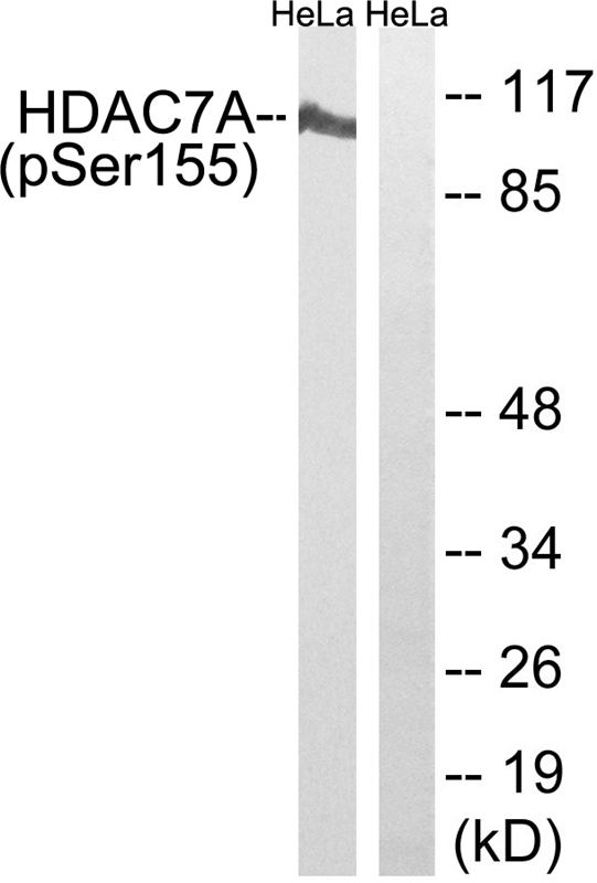 Rabbit Polyclonal Antibody to HDAC7A (Phospho-Ser155)