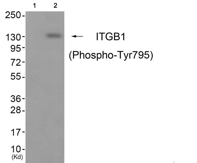 Rabbit Polyclonal Antibody to ITGB1 (Phospho-Tyr795)