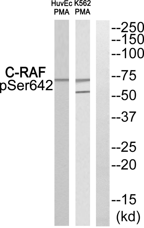 Rabbit Polyclonal Antibody to C-RAF (Phospho-Ser642)