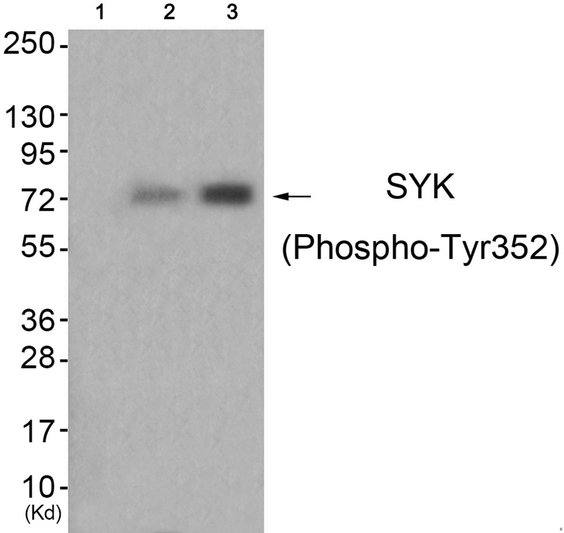 Rabbit Polyclonal Antibody to SYK (Phospho-Tyr352)