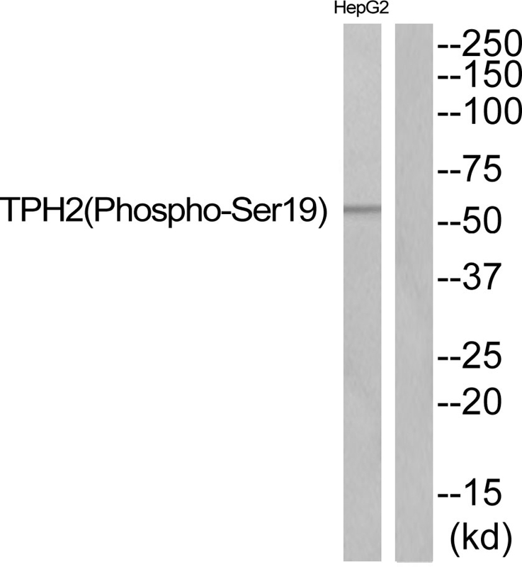 Rabbit Polyclonal Antibody to TPH2 (Phospho-Ser19)