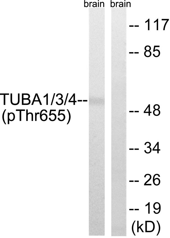 Rabbit Polyclonal Antibody to TUBA1/3/4 (Phospho-Tyr272)