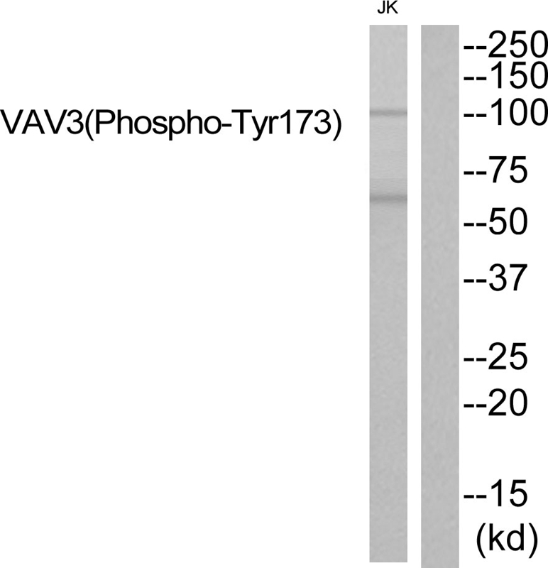 Rabbit Polyclonal Antibody to VAV3 (Phospho-Tyr173)