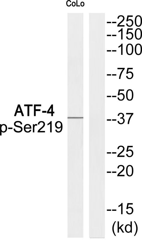 Rabbit Polyclonal Antibody to ATF-4 (Phospho-Ser219)