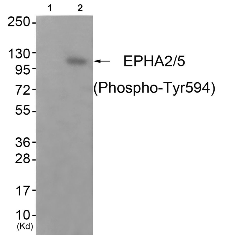 Rabbit Polyclonal Antibody to EPHA2/5 (Phospho-Tyr594)
