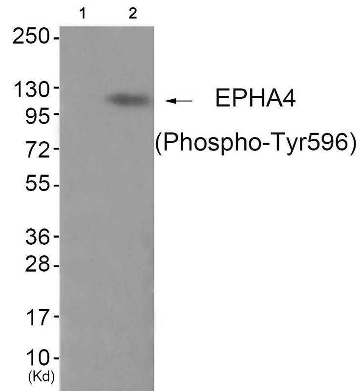 Rabbit Polyclonal Antibody to EPHA4 (Phospho-Tyr596)
